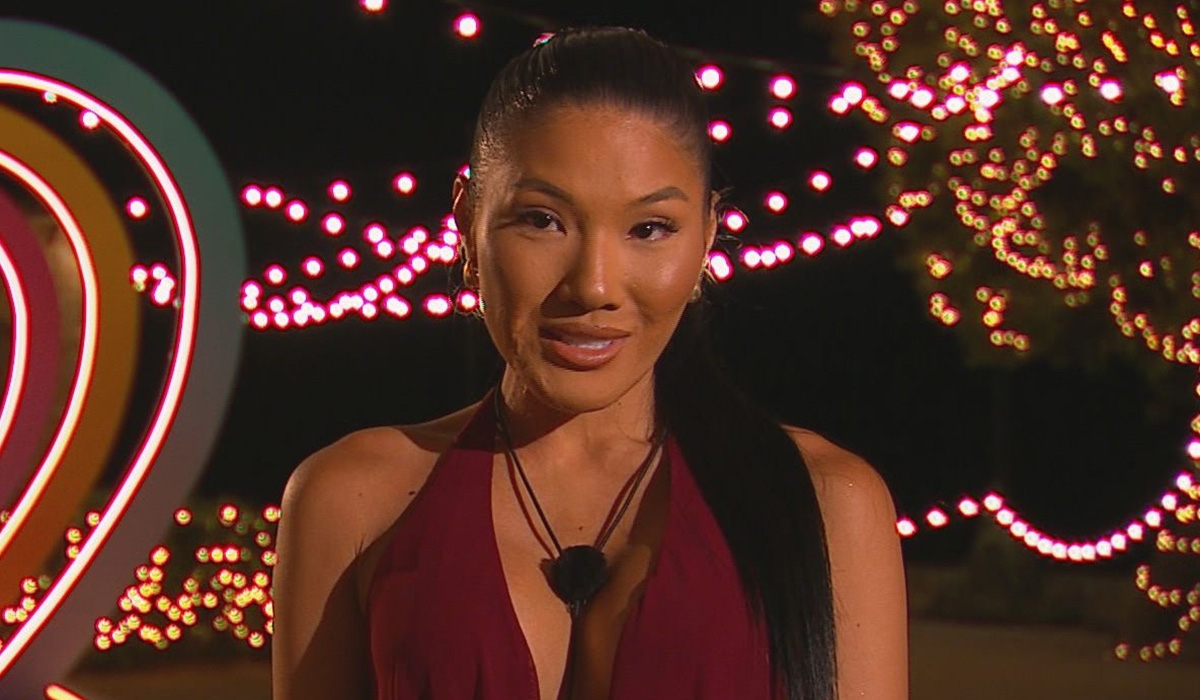 Love Island's Sophie Lee shares her inspiring story after life-changing burn injury