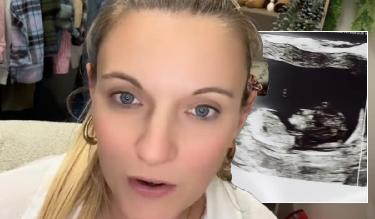 TV star doppelgänger? Mum's ultrasound sparks viral reaction