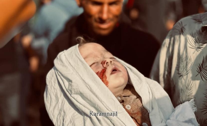 وزارة الصحة بغزَّة: 87 شهيدًا وصلوا مستشفيات القطاع خلال الـ 24 ساعة
