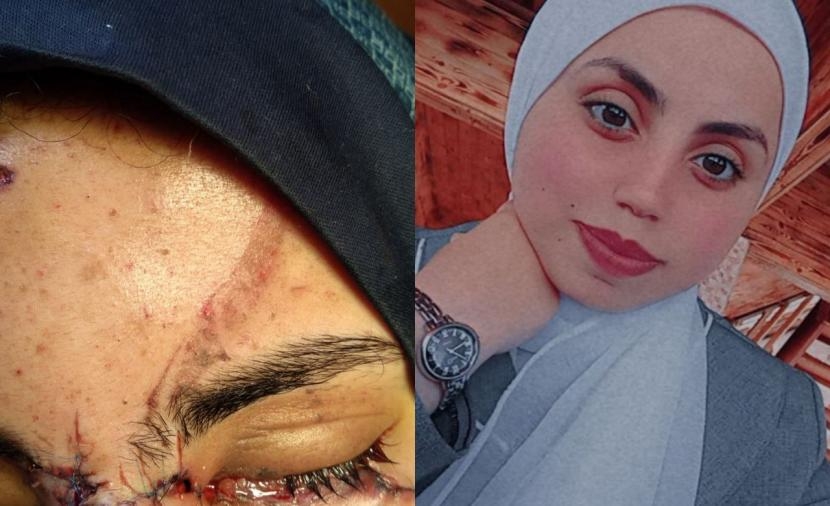 تقرير عيَّن حنين... شهادة حيَّة على وجع غزَّة الَّذي لا يمحى