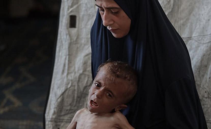 انتشار سريع لمرض "غيلان بارِّيه" في غزَّة... ومخاوف من وفيات جديدة