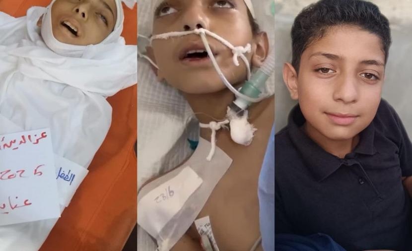 تقرير لم يصل إلى الدَّواء... الطِّفل "عز الدِّين" يستشهد قبل أن يشفى