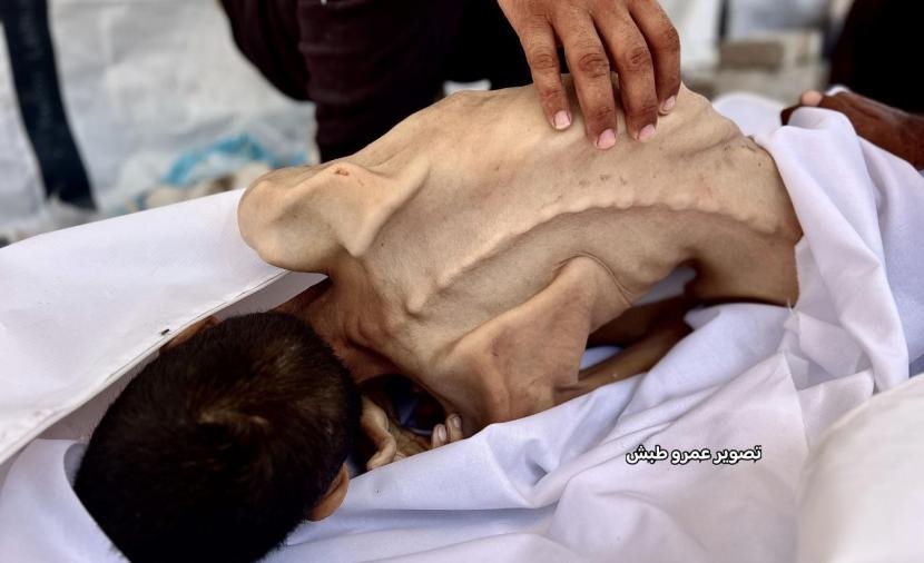ارتفاع ضحايا المجاعة في غزَّة إلى 162 شهيدًا بينهم 92 طفلاً