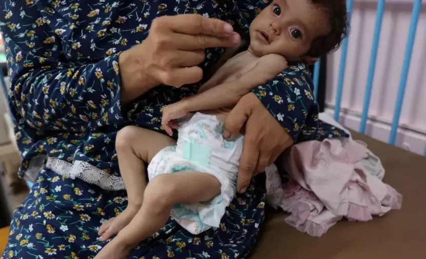 "غيلان باريه".. مرض نادر يفتك بأطفال غزة وسط نقص حاد في العلاج