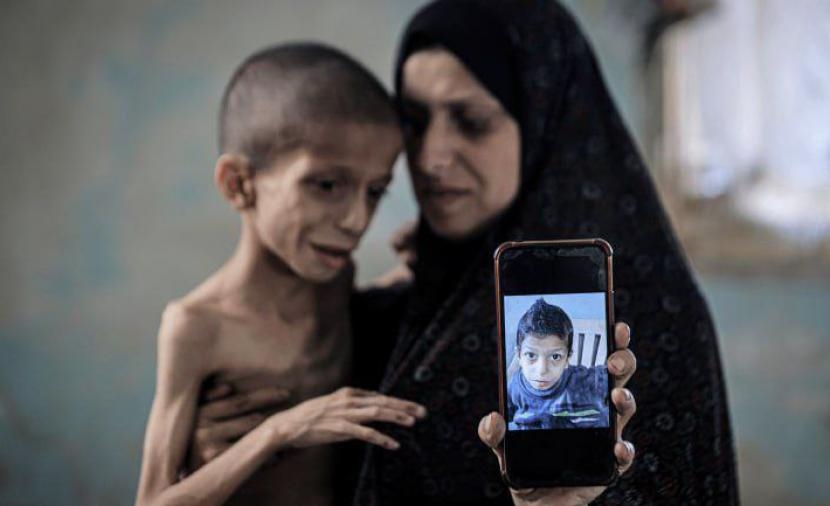 تقارير... غزَّة تواجه تهديدًا قاتلاً مع انتشار الأمراض المقاومة للمضادَّات الحيويَّة