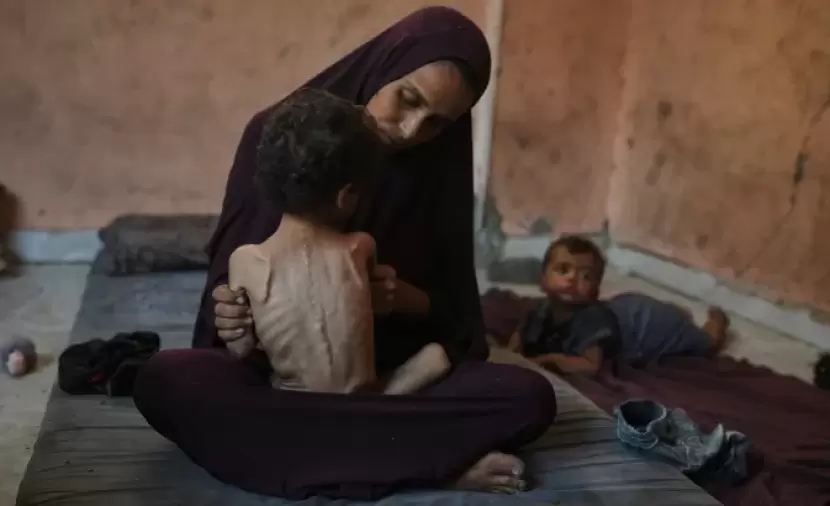 كارثة صحيَّة جديدة... مرض الشلل المتصاعد يهدد أطفال غزة