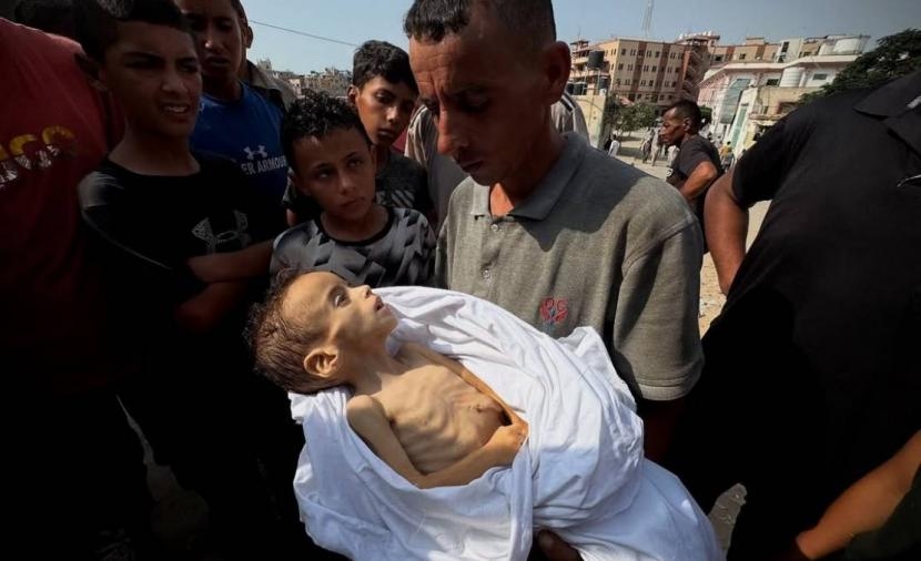 وفاة طفل نتيجة المجاعة وسوء التَّغذية بغزَّة