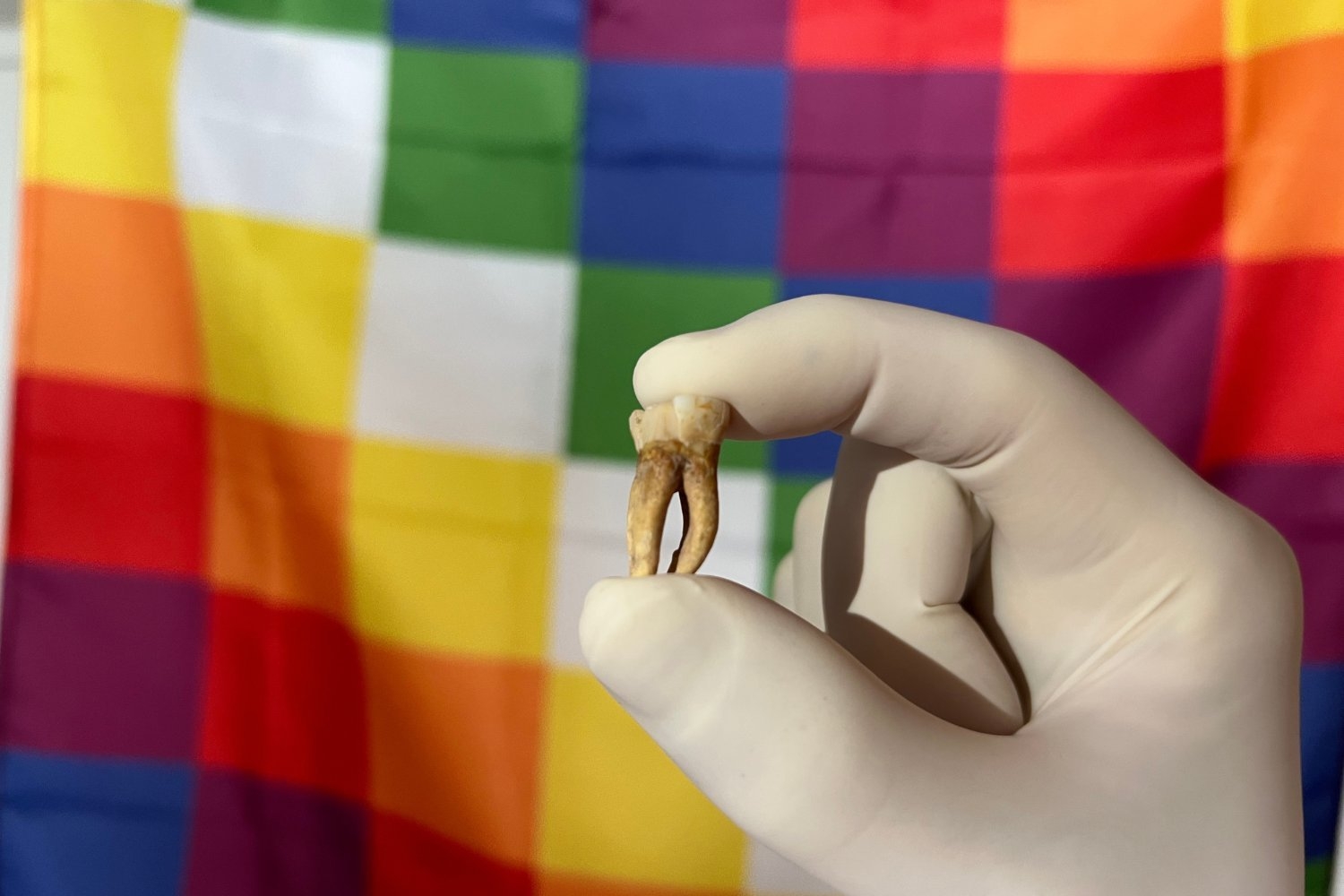 Leprosy's Origins Are Even Weirder Than We Thought