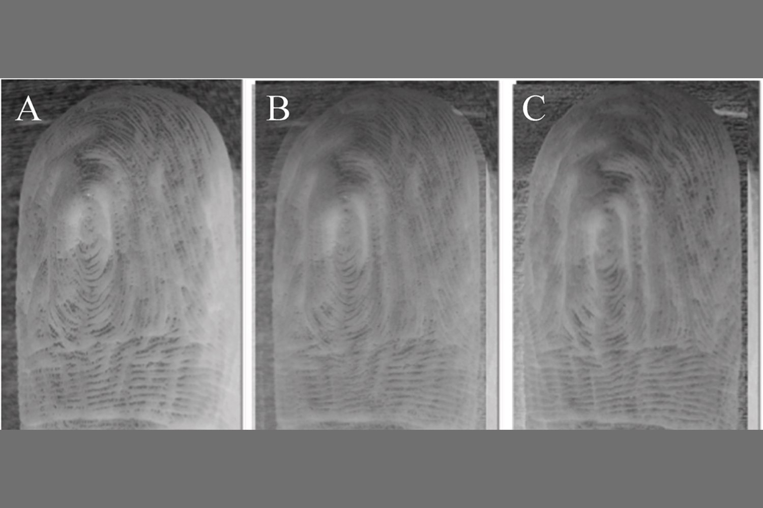 Your Pruney Fingers After After a Bath Always Wrinkle the Same Way, Study Reveals