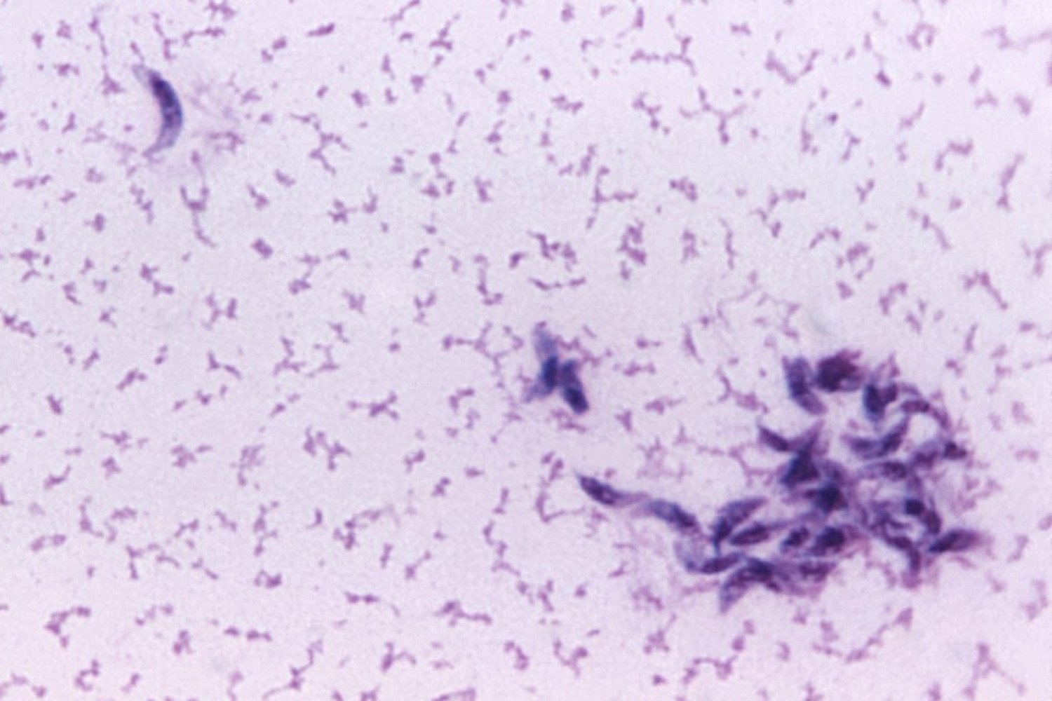 This Cat Poop Parasite Can Decapitate Sperm—and It Might Be Fueling Infertility