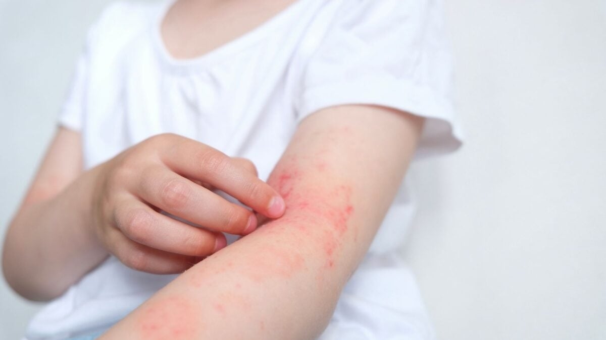 Study Says U.S. Babies Are Missing a Key Gut Microbe, Fueling Allergy Risk