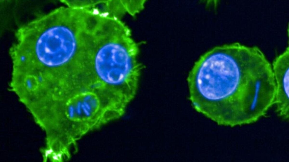 This Genetic ‘Trick' Helped the Black Death Linger for Centuries