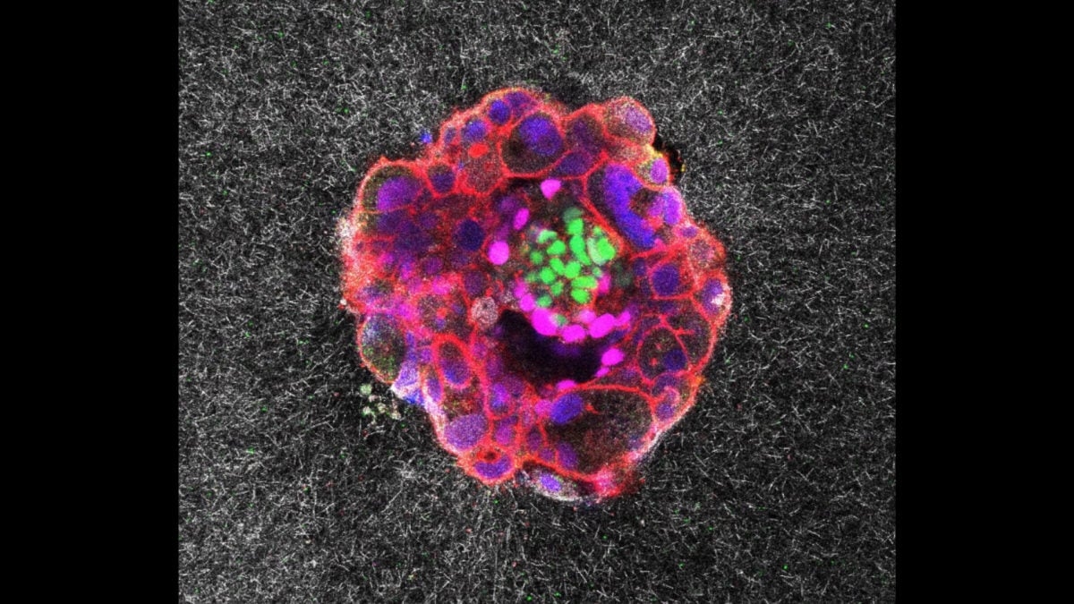 In a First, Scientists Capture Human Embryo Implantation in Real Time