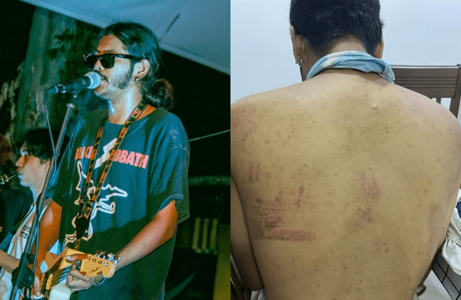 Police Arrest 6 Suspects Over Assault On Armpunk Sindicate Vocalist Zed