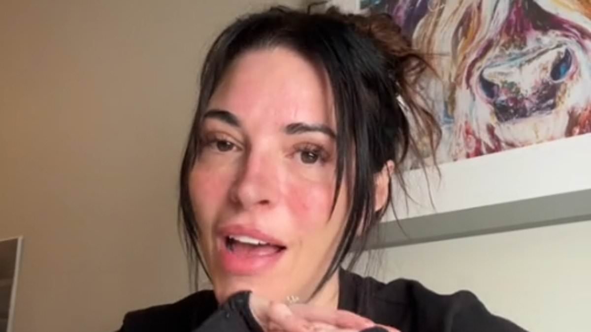 I've been diagnosed with an autoimmune disease - here are all the warning signs I missed