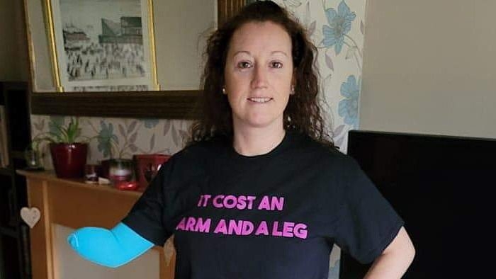 Woman left wheelchair-bound after 'suicide disease' led to her hand and leg being amputated