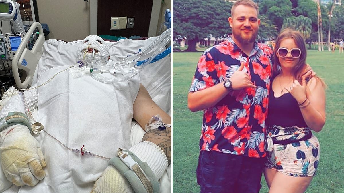Father-of-two, 25, spent three weeks in a coma after freak s'mores accident