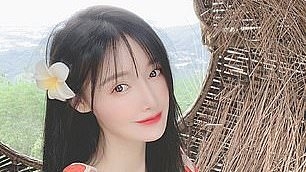 My nose turned black after a rhinoplasty gone wrong: This is my warning to other people having plastic surgery