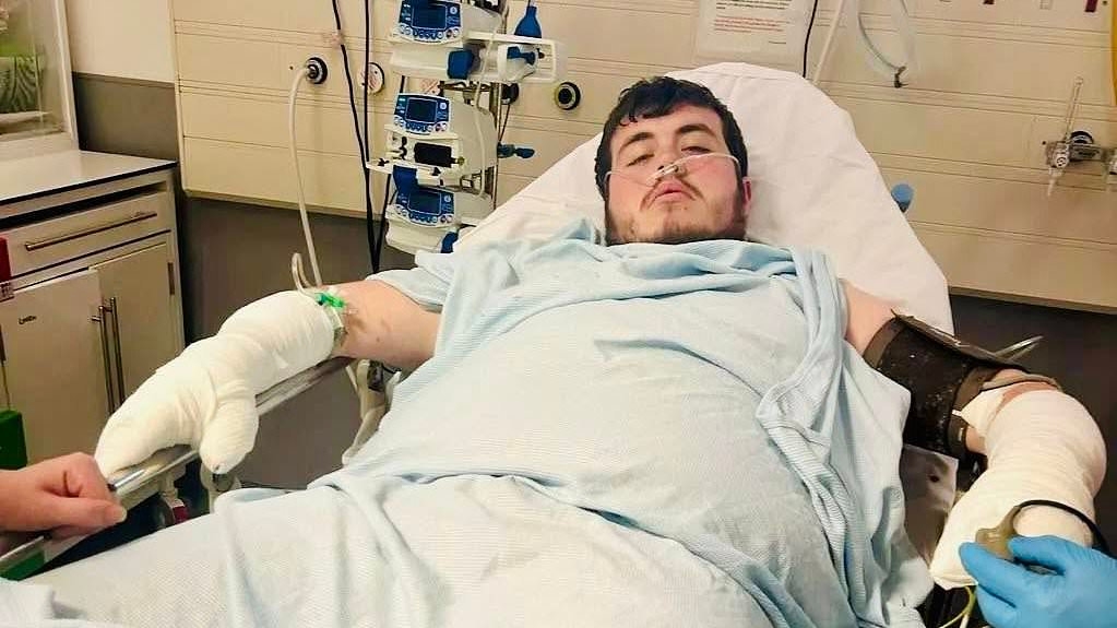 Hero bystander suffers horror injuries as he stops woman and newborn baby being attacked by three dogs