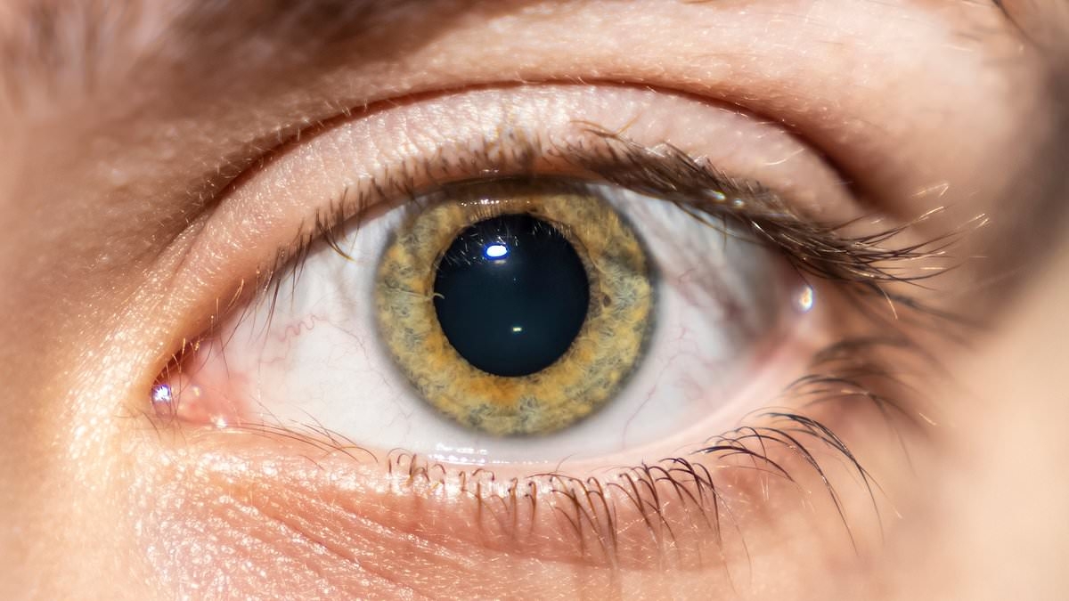 The subtle clue in your EYE that could mean you'll get dementia as young as 45