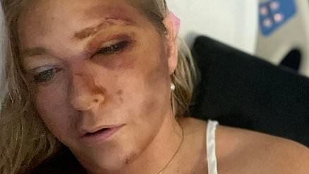 How Virginia Giuffre's life turned to hell after Prince Andrew's multi-million pound payout: From messy marriage breakdown to bizarre bus crash and spate of hospital admissions