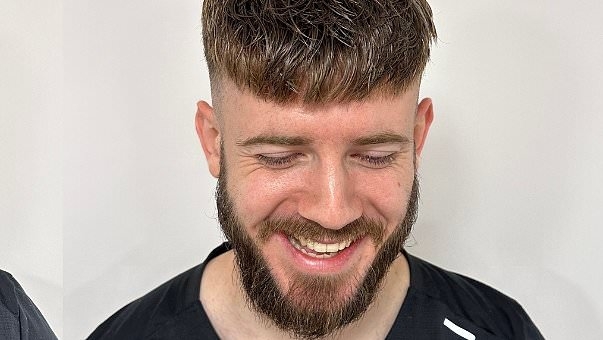Man who went bald at 26 astounds social media with jaw-dropping hair transformation - and no surgery or drugs are involved