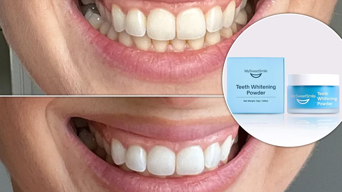 Amazon's top-rated teeth whitening brand is up to 40% off right now - and shoppers say 'it works from the first use'