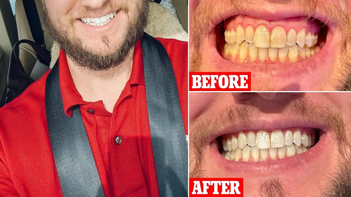 I tried the popular dentist-approved product that promises whiter teeth in six days - here's my brutally honest review