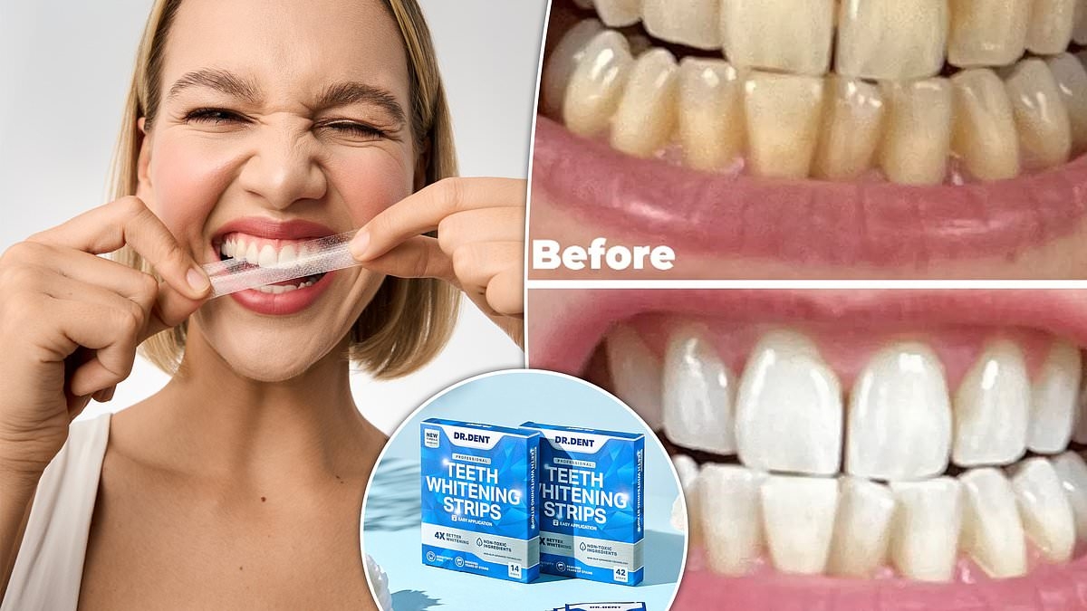 Amazon shoppers are raving about these whitening strips that leave teeth eight shades whiter in ONE week - and you can now get them for 23% off