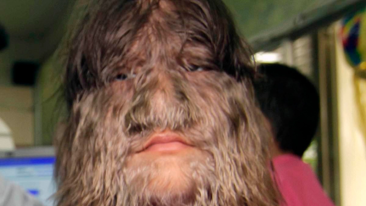 'World's hairiest girl' finds love again after split - and she now looks VERY different