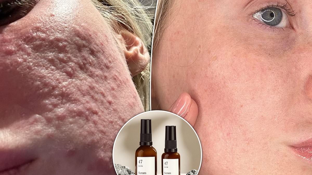 Thousands of customers SWEAR by this brand for problem skin and breakouts - here's why
