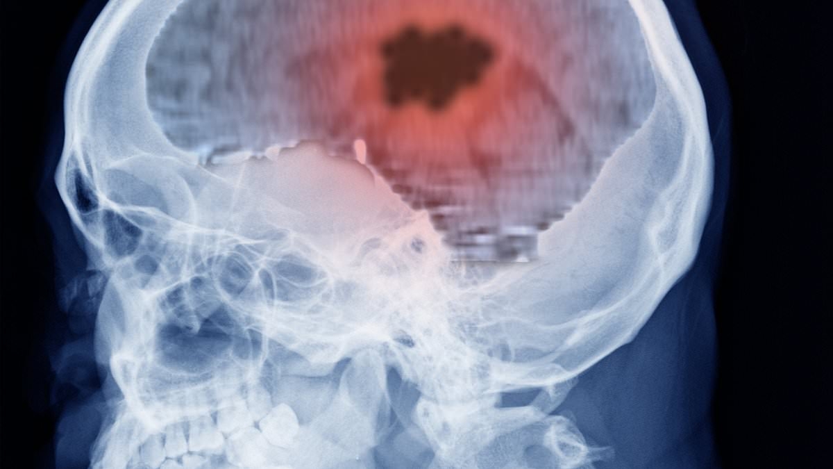 Medic demonstrates a 30-second brain tumor test you can do right now to pick up symptoms