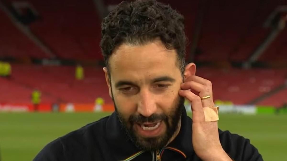 Man United manager Ruben Amorim is forced into covering latest cuts on his knuckle with a plaster just months after he 'smashed dressing room TV during angry outburst'