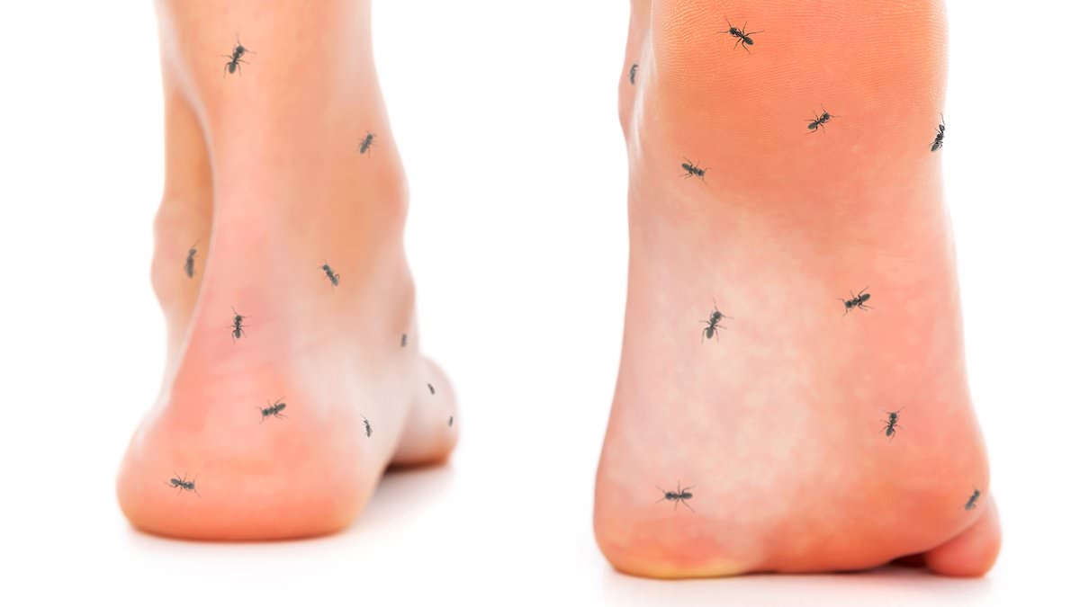 I feel like swarms of ants are crawling all over my leg when I try to sleep. What's happening to me? DR MARTIN SCURR has the troubling answer