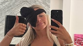 Love Island's Chloe Burrows sparks concern as she shows off swollen face before sporting an eyepatch amid mystery ailment