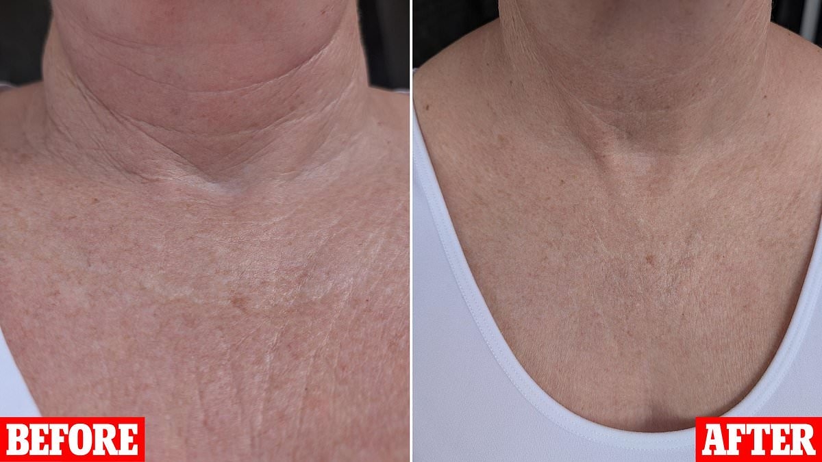 I tried the revolutionary new beauty buy that targets neck wrinkles and I'm honestly blown away by the results