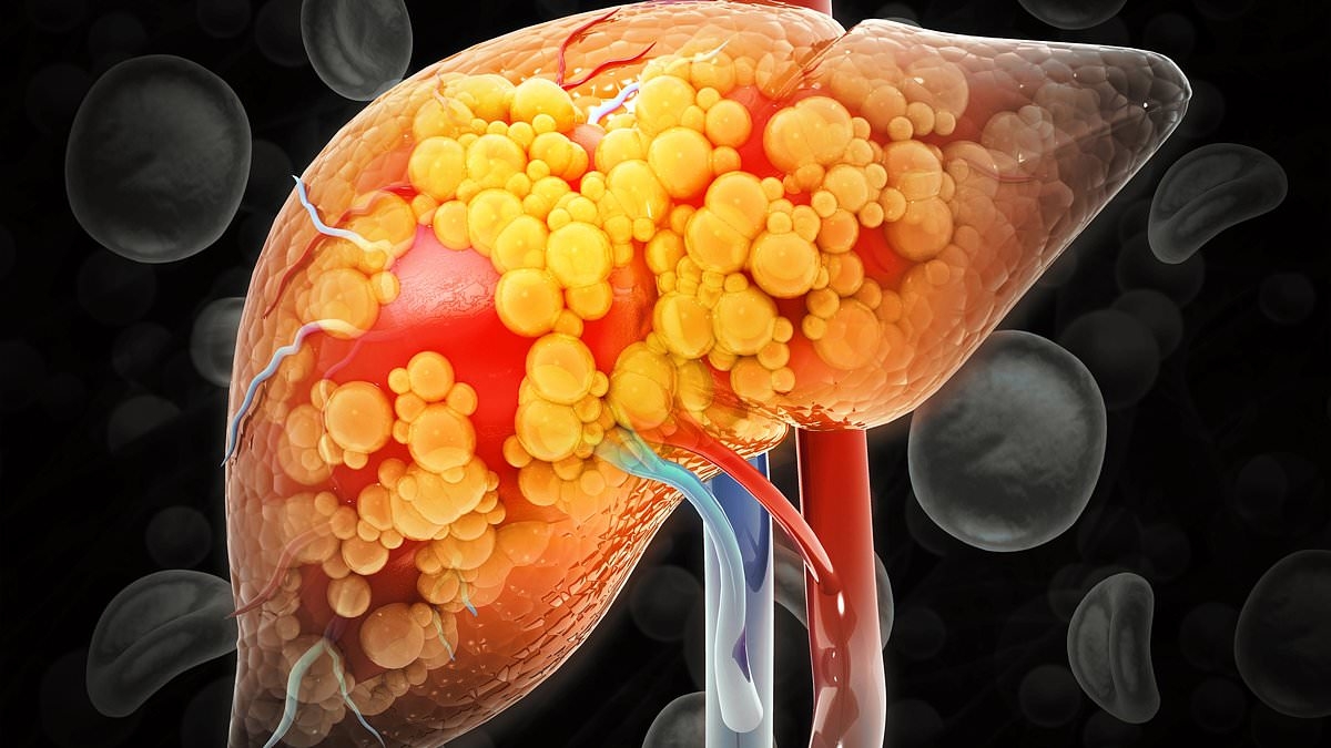 GSK agrees $2bn deal to buy potential liver disease treatment