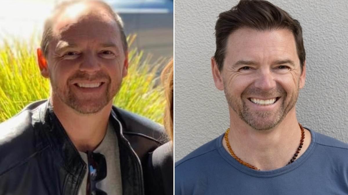 I started going bald at 20. I tried every 'snake oil' remedy out there until I learned one simple fact about hair loss. This is the secret that saved me: DAVID ALLEN