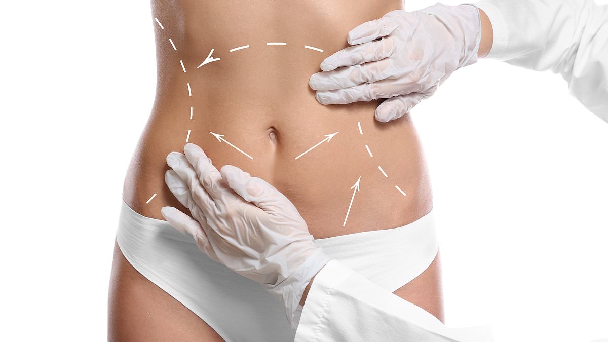 Warning as deadly superbug reaches the UK thanks to cosmetic surgery patients getting cheap ops abroad