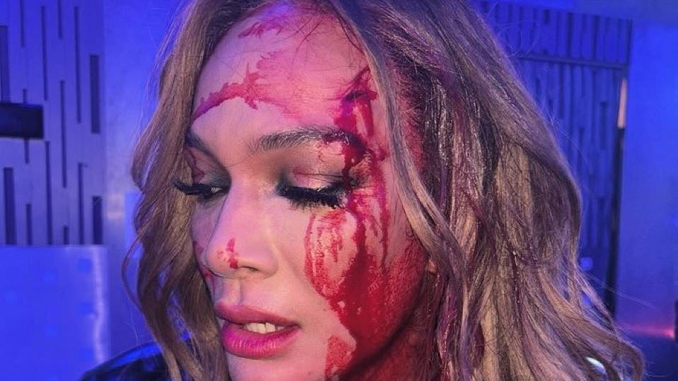 Nia Jax reveals gruesome facial injury after brutal chair shot goes wrong on live TV in WWE title loss to Tiffany Stratton