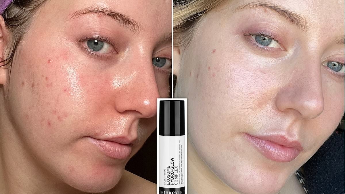This £20 glow-giving serum left my skin smoother, brighter and blemish-free in just one MONTH