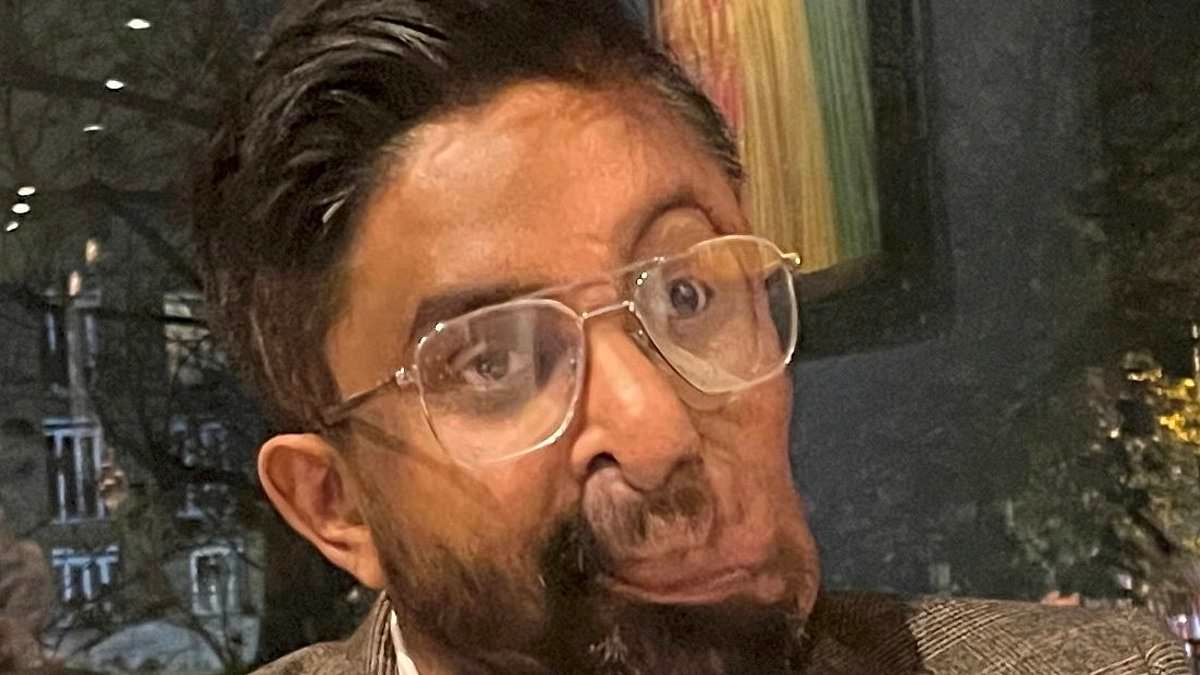 Man claims cafe refused to serve him and looked like they'd 'seen a ghost' because of his facial tumours