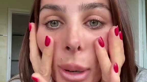 TikTok star Indy Clinton addresses her uneven nostrils after being trolled over her rhinoplasty