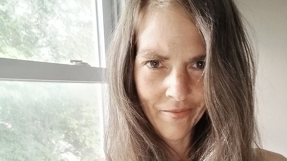 EXCLUSIVE I was left with horrific fourth-degree burns after trying habit of 17m Americans for first time