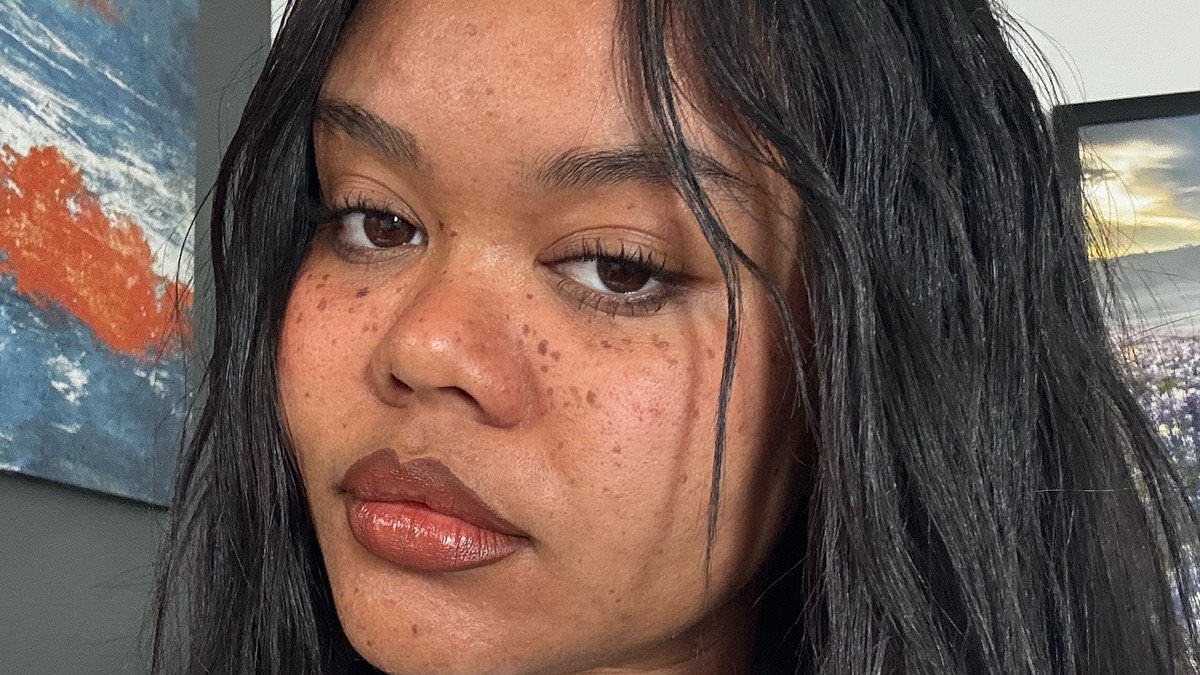 I was prescribed a common antibiotic and wasn't told of the risks... it caused my organs to fail
