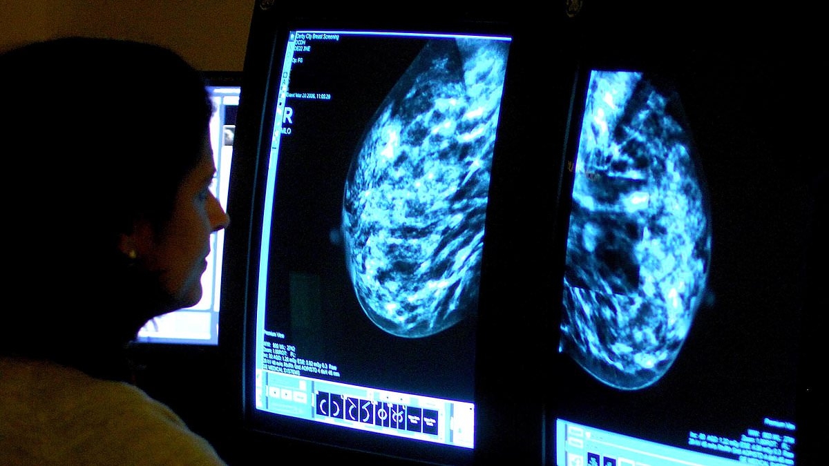 Fresh calls for health chiefs to give breakthrough breast cancer drug green light as pivotal trial shows it boosts survival