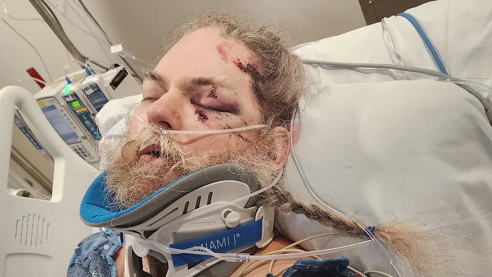 Man with special needs suffers horrifying injuries after being struck by a TORNADO