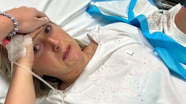 Tourist's finger left hanging off after shark attack in Jamaica