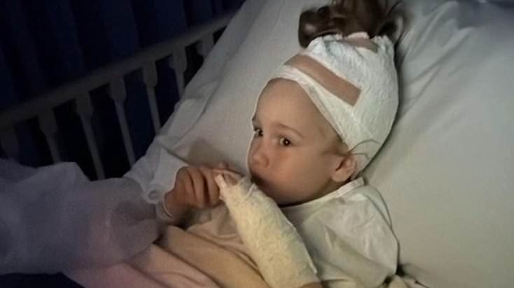 Parents' horror as their six-year-old girl is mauled by an American staffy in a public park and almost SCALPED
