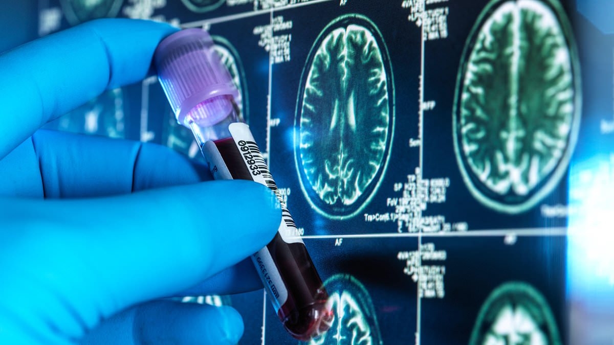 How dementia could be triggered by cold sore virus: Cutting-edge research shows it can inflame your brain. But doctors say there's a free NHS jab that can slash your risk - and reveal what to ask for